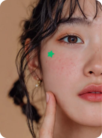 Thai Acne Care